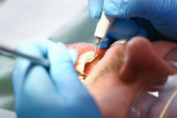 Best Emergency Treatment for Oral Infections in Rotan, TX