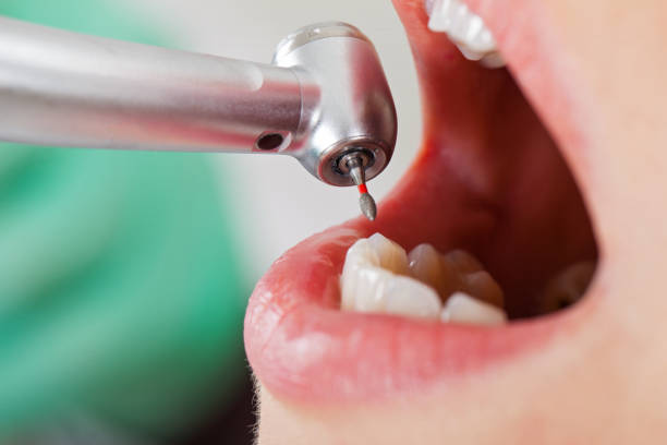 Best After-Hours Dental Care in Rotan, TX